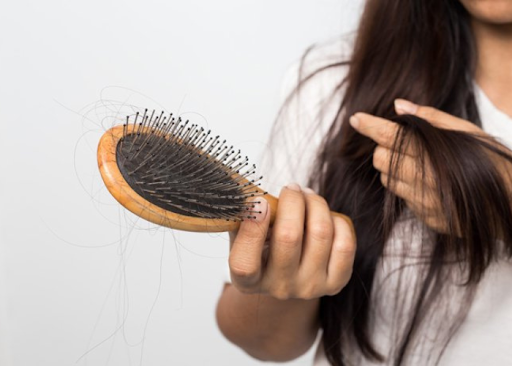 Cách chăm sóc tóc rụng cực đơn giản và hiệu quả 