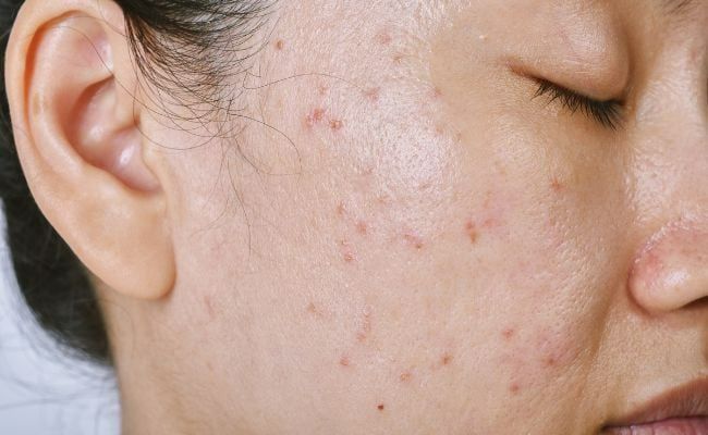 Ban đêm là lúc da hấp thụ các dưỡng chất tốt nhất