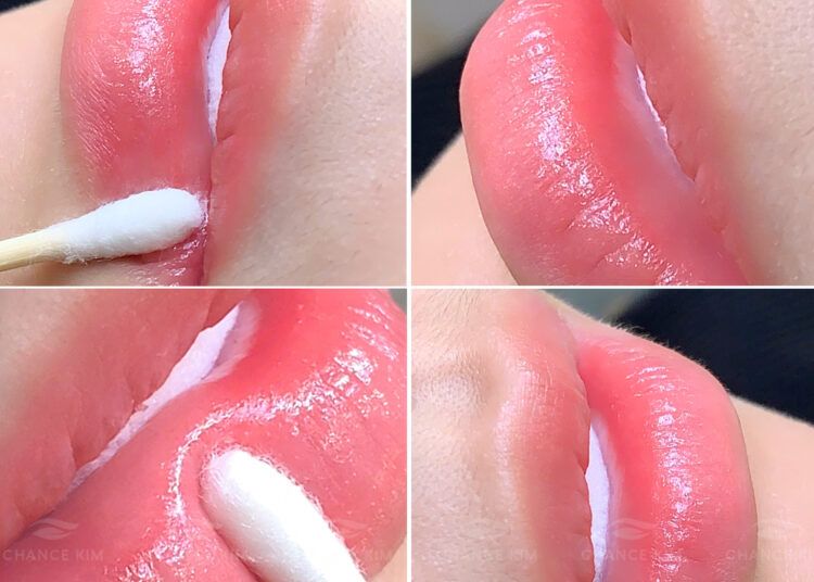 Giải đáp những câu hỏi thường gặp