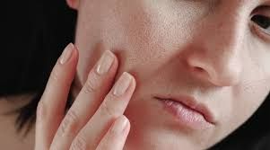 Da xỉn màu là gì? Nguyên nhân và cách cải thiện cho làn da sáng khỏe